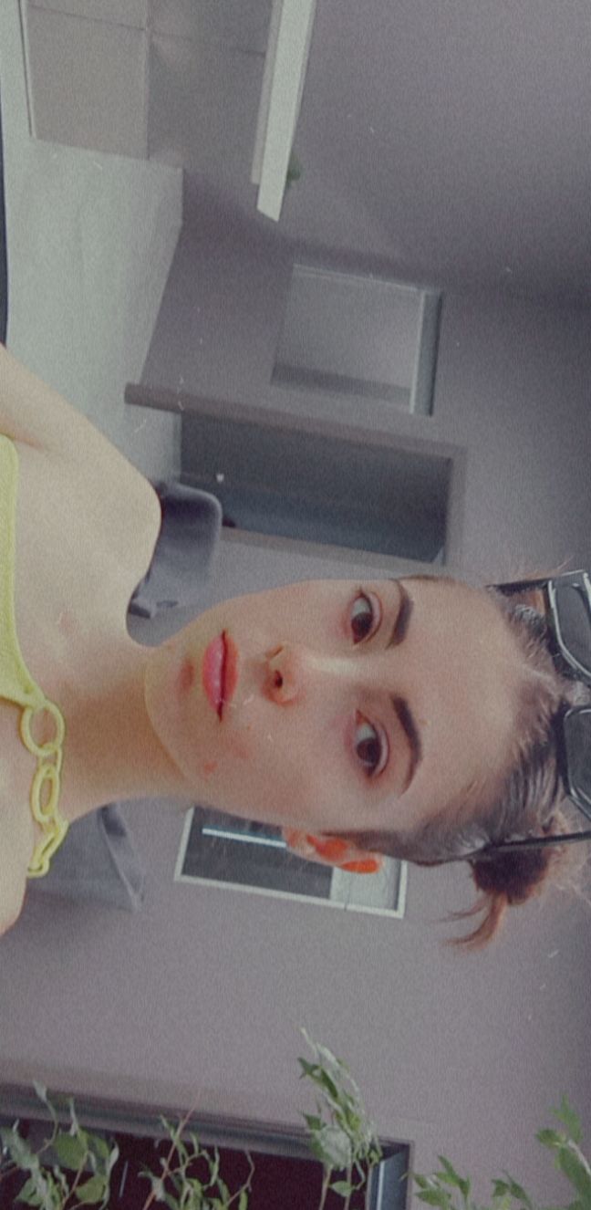 Why is it that my pimples look more noticeable under fluorescent light?