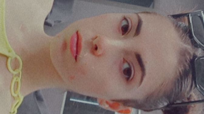Why is it that my pimples look more noticeable under fluorescent light?