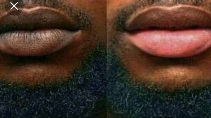 This one got the smokers does your lips and gums return back to normal color (pink) after you quit smoking weed / cigs?
