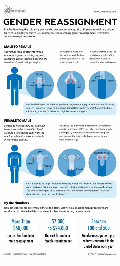 Should I get a gender reassignment surgery?