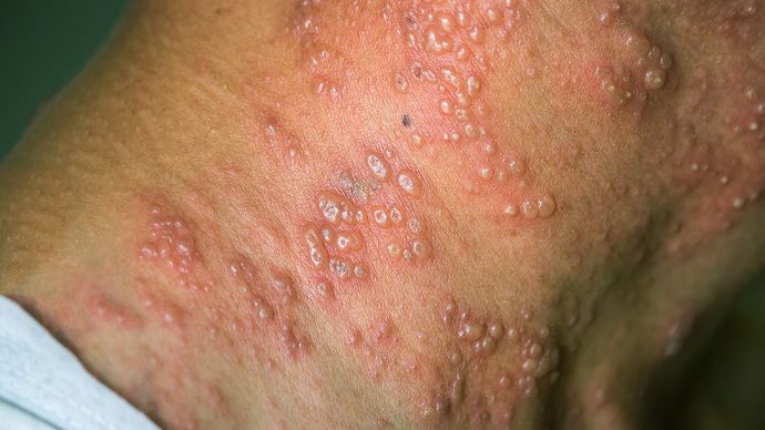 What do you think about this new virus outbreak?