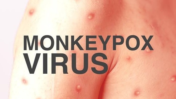 What do you think about this new virus outbreak?