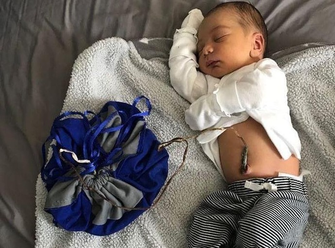 What would happen if the umbilical cord is never cut?