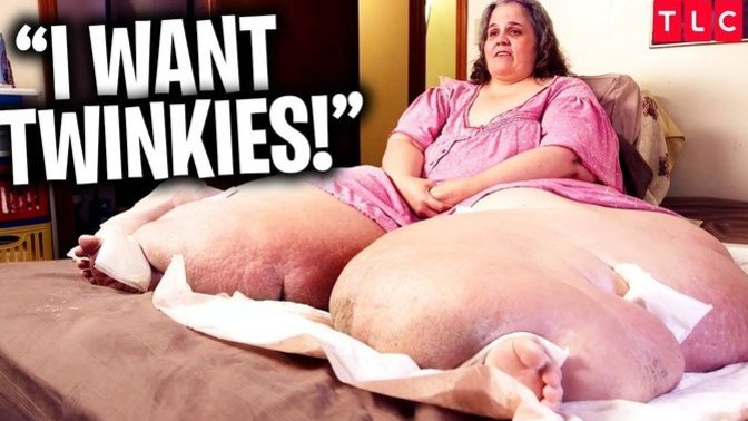Why is fat phobia a thing when over 3 million children a year die from hunger?