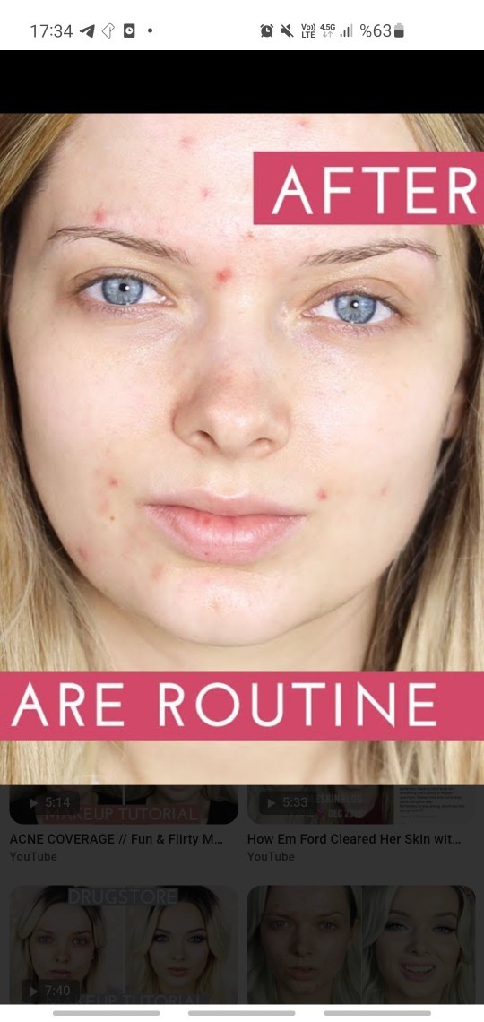 I cant look in the mirror, my skin is so pale and white, it looks sick and I have some acne spots, how can it look healthy?