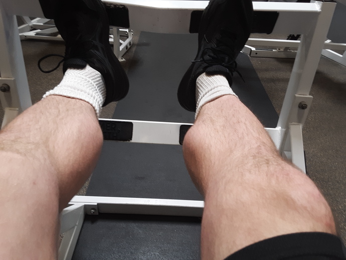 Do you have any physical features that random strangers make remarks to you about?
