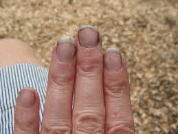 Would you date someone who always had dirty fingernails?