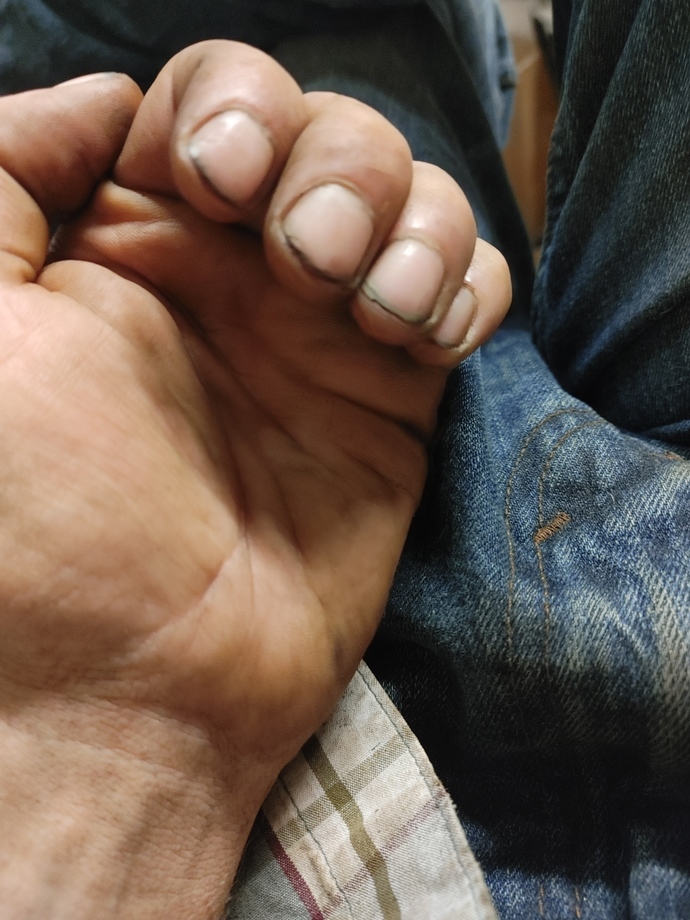 Would you date someone who always had dirty fingernails?
