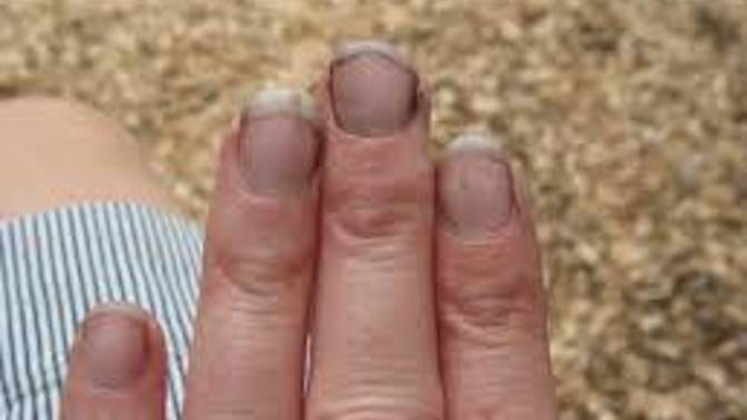 Would you date someone who always had dirty fingernails?