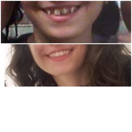 How did the change happen?