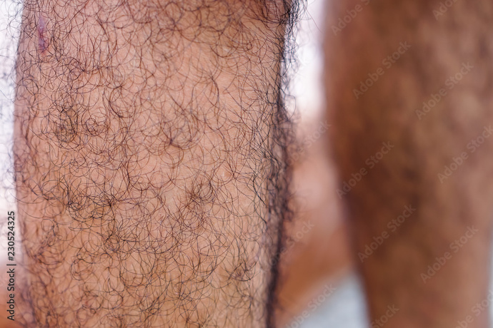 Do you think hairy legs and thighs look appealing and attractive on men?