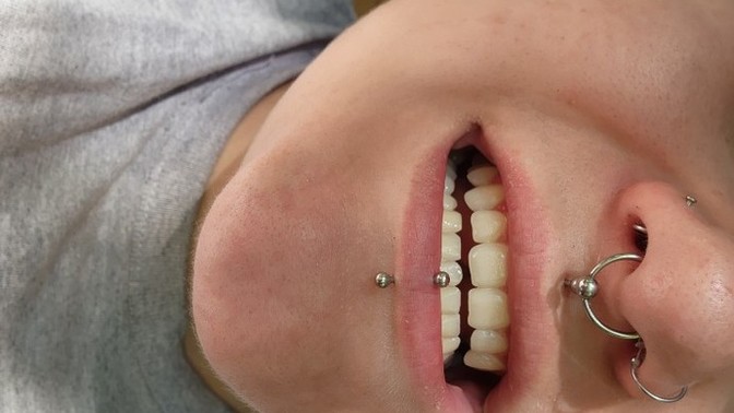 Did you straighten your teeth or are they natural?