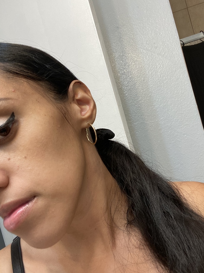 HELP HOW WHY DO I HAVE A BALD SPOT? HOW CAN I GET THICKER HAIR ANY TIPS?