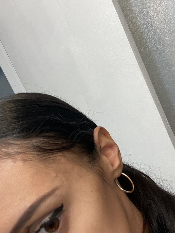 HELP HOW WHY DO I HAVE A BALD SPOT? HOW CAN I GET THICKER HAIR ANY TIPS?