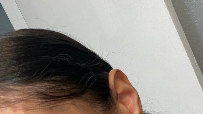 HELP HOW WHY DO I HAVE A BALD SPOT? HOW CAN I GET THICKER HAIR ANY TIPS?