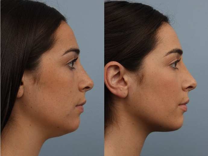 Do double chins bother you when they’re not on fat people?