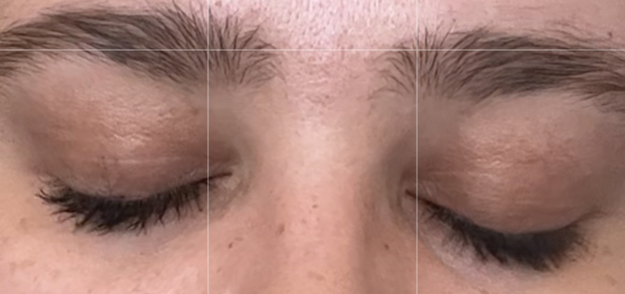 How do I fix discolouration on my eyelids?