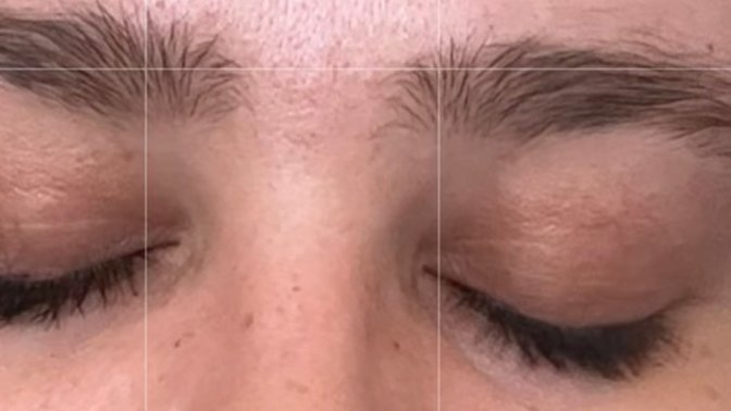 How do I fix discolouration on my eyelids?