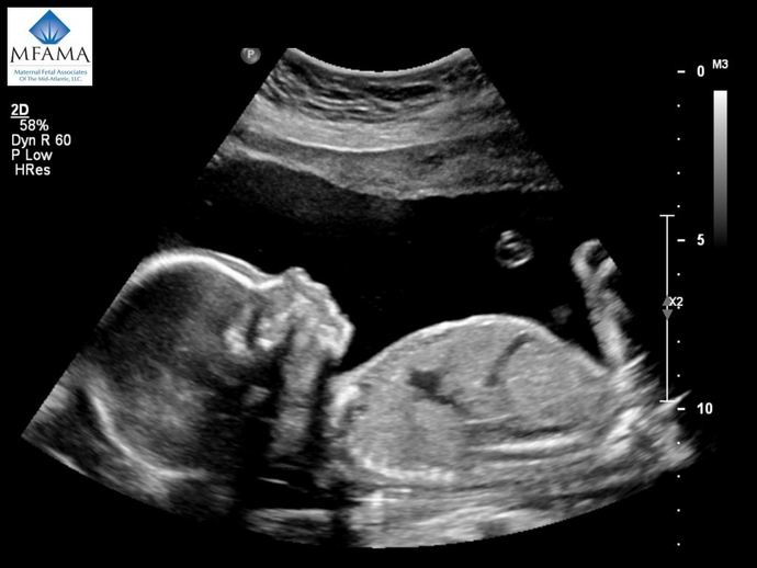How would you feel if your significant other and you had a baby and she/he decided to name their opposite gender child his/her exs name?