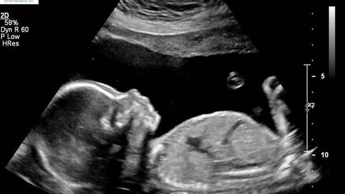 How would you feel if your significant other and you had a baby and she/he decided to name their opposite gender child his/her ex's name?