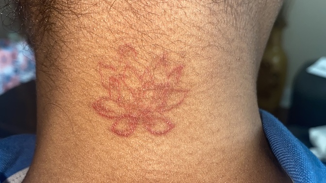 Should I get my tattoo redone, covered up or leave it be?