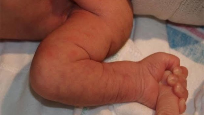 Sometimes my skin looks like a newborn baby. Should I go to the doctor?