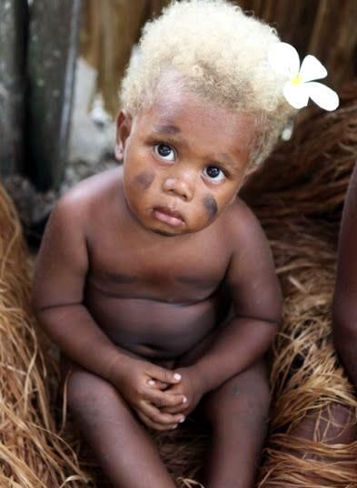 Can black people be born with blonde hair?