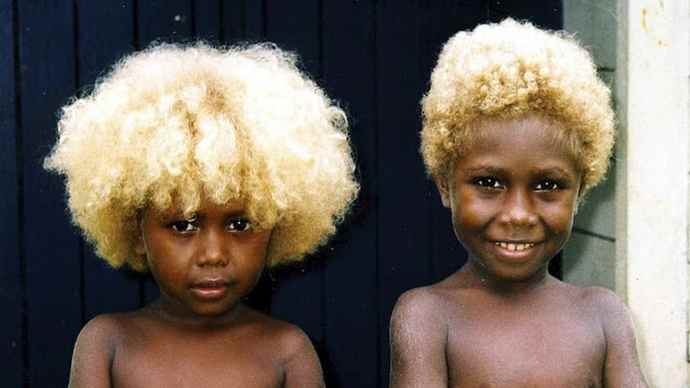 Can black people be born with blonde hair?