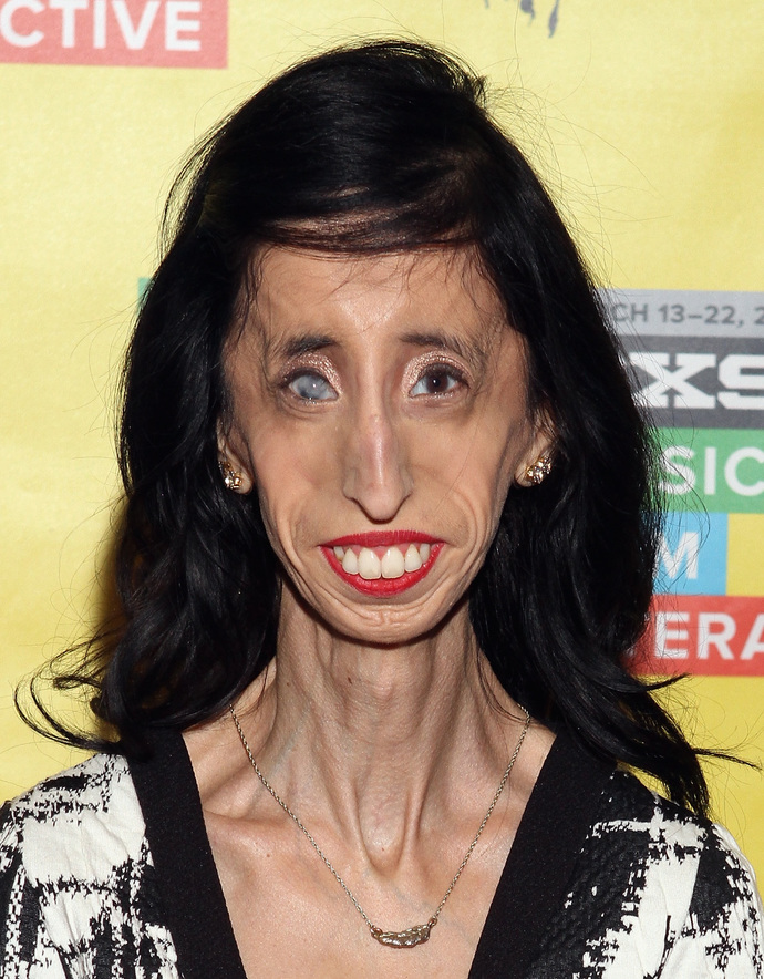 Lizzy Velasquez