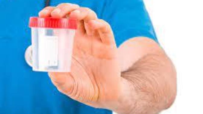 How To Pass An ETG Test In 24 Hours?