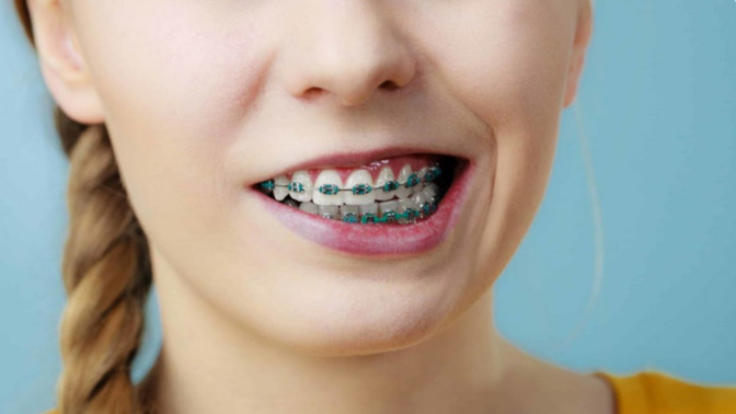 How much do braces hurt on a scale 1-10?