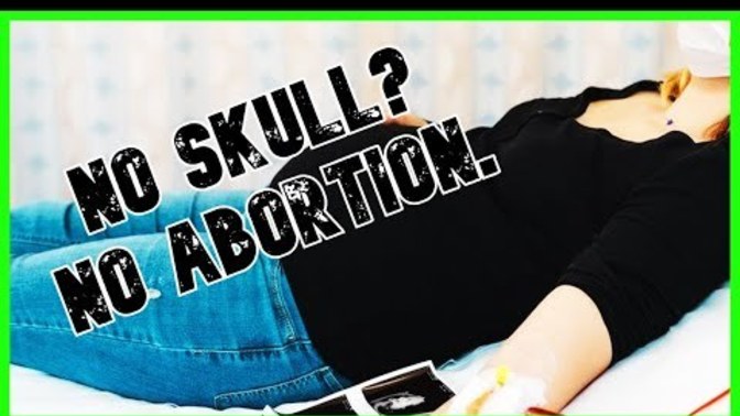 Louisiana Woman FORCED To Carry Skull-less Fetus To Term. Your thoughts?