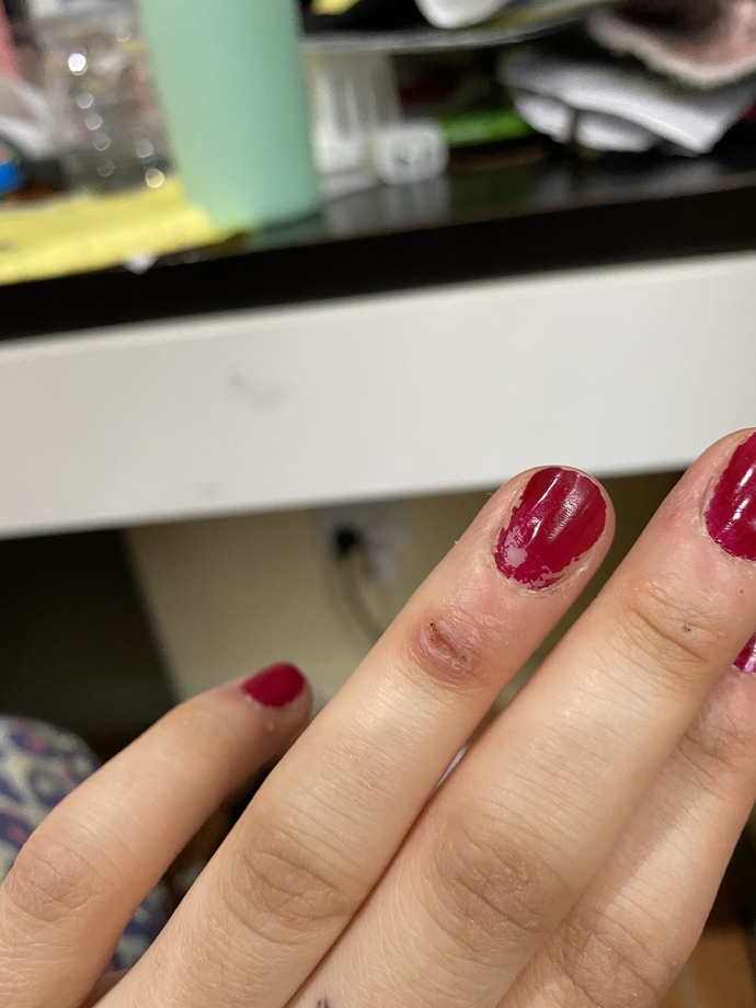 Does this cut look infected?