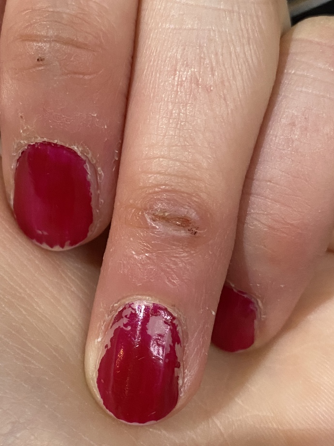 Does this cut look infected?
