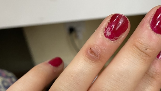 Does this cut look infected?