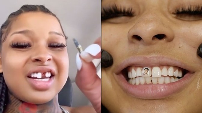 Could you ever love someone enough to remove your tooth and get their face tattooed on it?