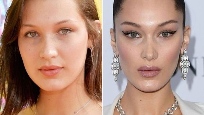 Is Bella Hadid pretty?