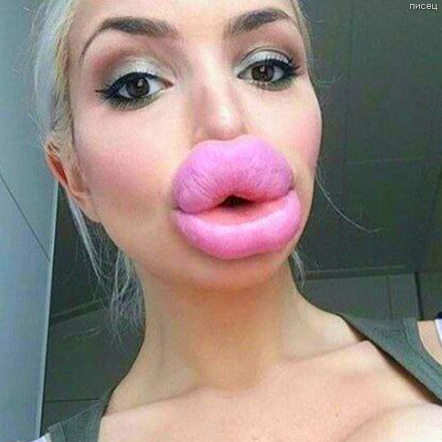 What do you think of injected lips like these?