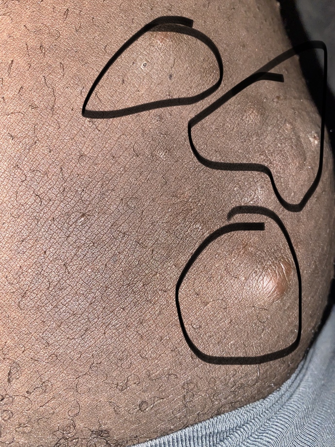 What are theses things on my thigh?