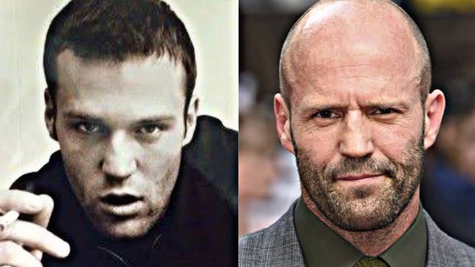 I am going bald at a very young age and I don't how to deal with it. What do I do?