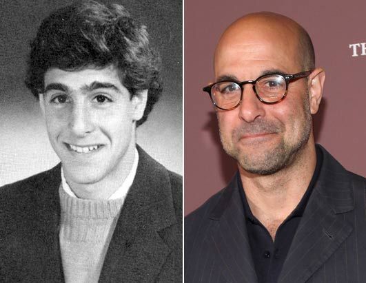 I am going bald at a very young age and I don't how to deal with it. What do I do?