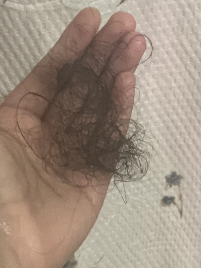 Is this a normal amount of hair to lose after not using a brush for 4 days?