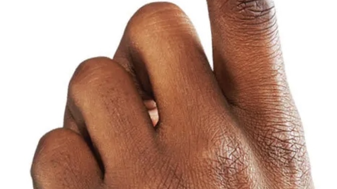 Are bandaid companies racist for just now making black skin tone bandaids?