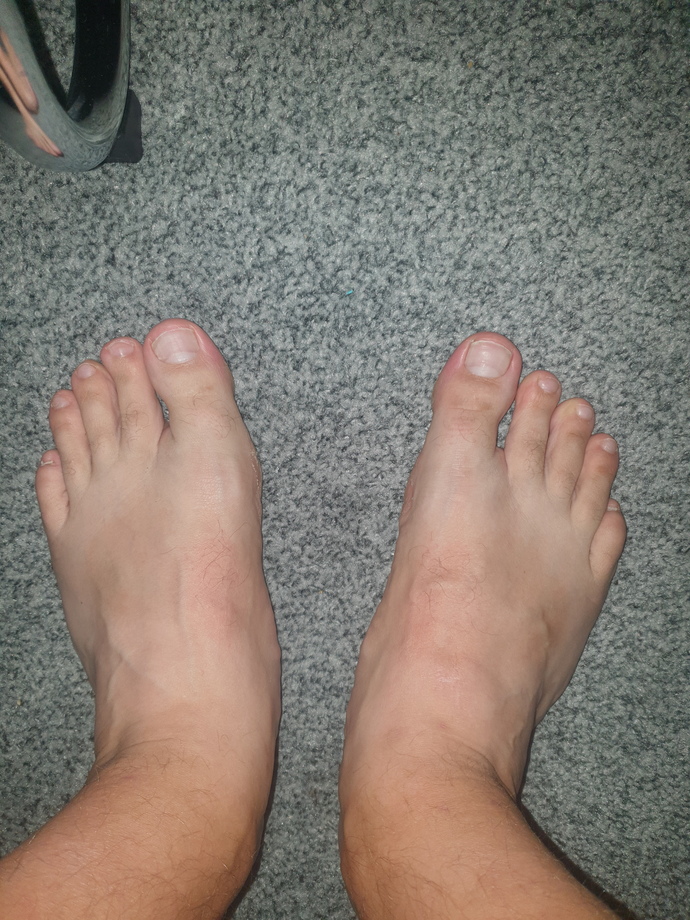 Can I wear sandals?