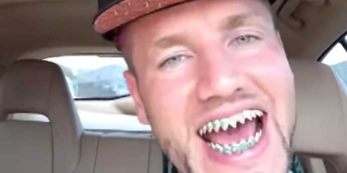 Could you still date someone who was perfect in every way except for ONE thing: they have shark teeth?