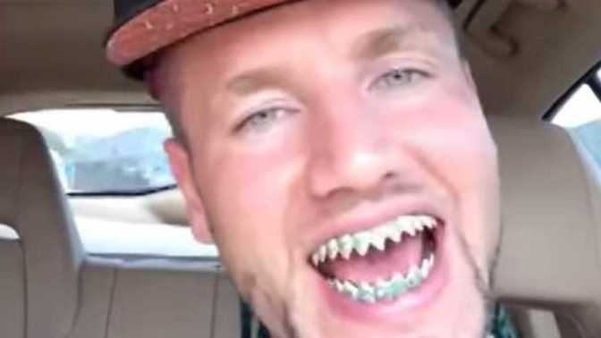 Could you still date someone who was perfect in every way except for ONE thing: they have shark teeth?