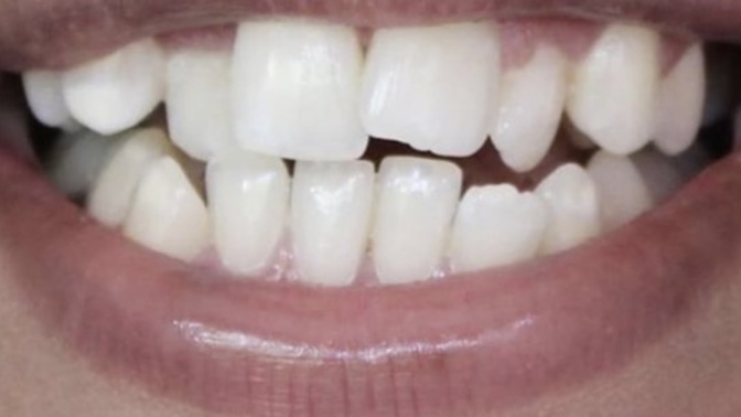 How would you feel about a friend or significant other with teeth exactly like this?