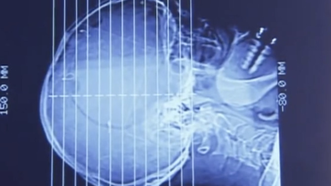 Did you know we "Auto-Think" anything we hear as True?