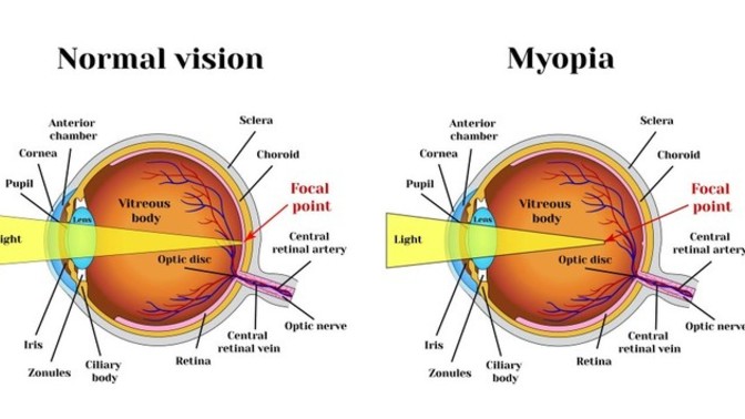 Do you use plus lenses when looking close?