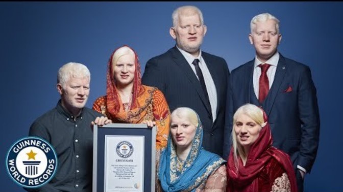 Why do we continuously call white people "white", when they look nothing like albinos?
